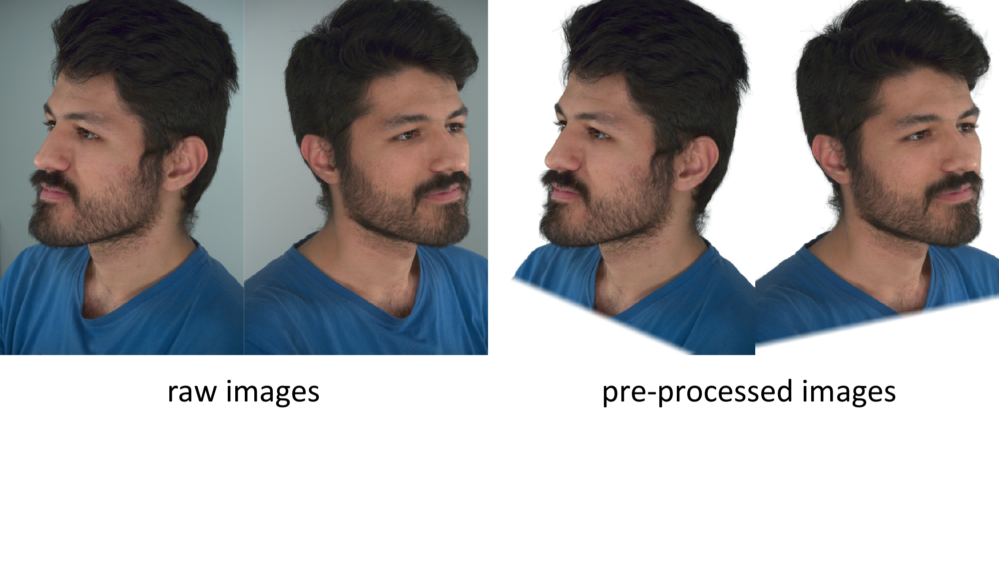 We remove the background and pixels below the shoulder to focus on the head region.