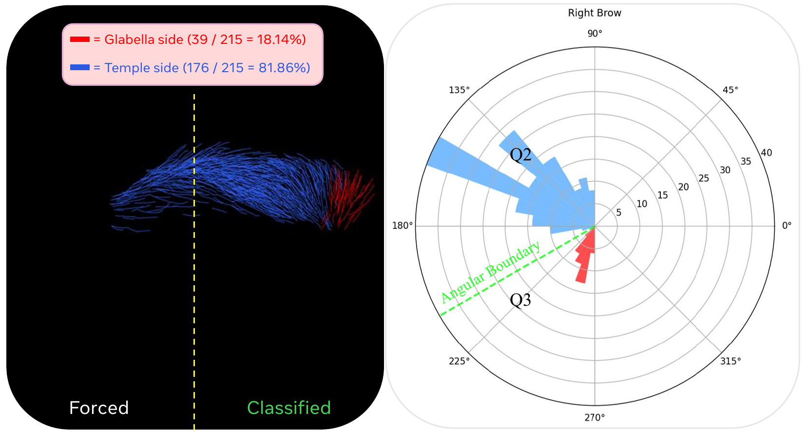 Visualization of root-tip ambiguity resolve process of eyebrows. Rose diagram of strand growth directions for the inner half of each eyebrow. Vectors are computed from the glabella-side (inner) to temple-side (outer) endpoint in frontal projection. Strands below the angular threshold (green, 30°) are classified as root=outer, indicating ambiguous growth direction near the glabella. The angular distribution exhibits a bimodal pattern, with a natural gap near the decision boundary, validating the threshold-based classification